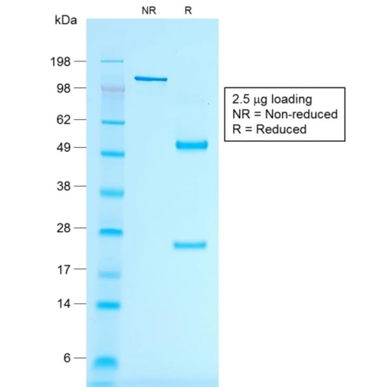 SDS-PAGE - Anti-MelanA Antibody [rMLANA/788] (A248552) - Antibodies.com