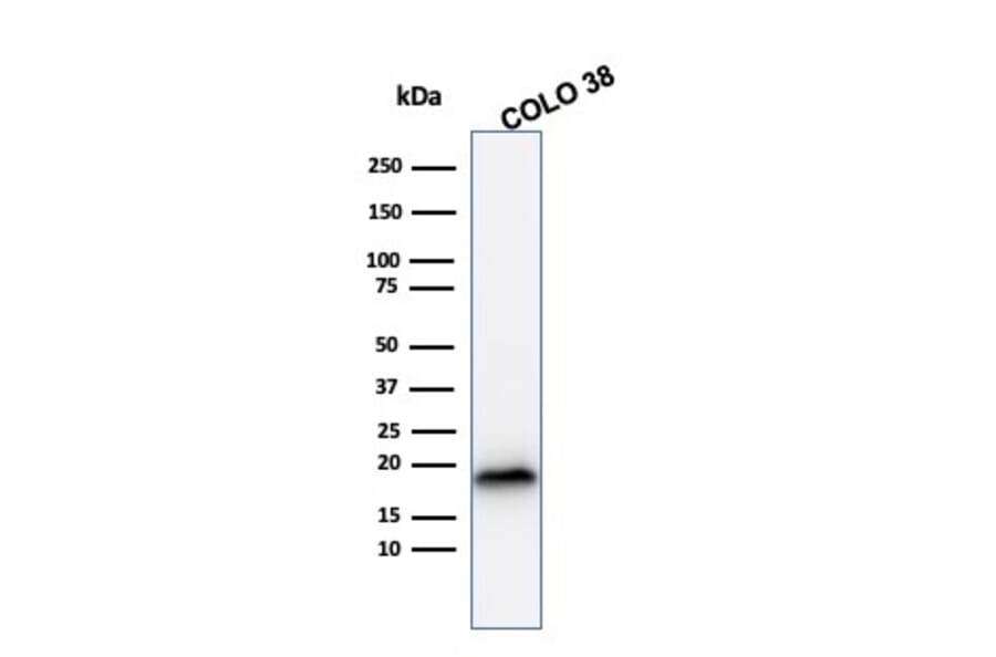 Western Blot - Anti-MelanA Antibody [rMLANA/788] (A248552) - Antibodies.com