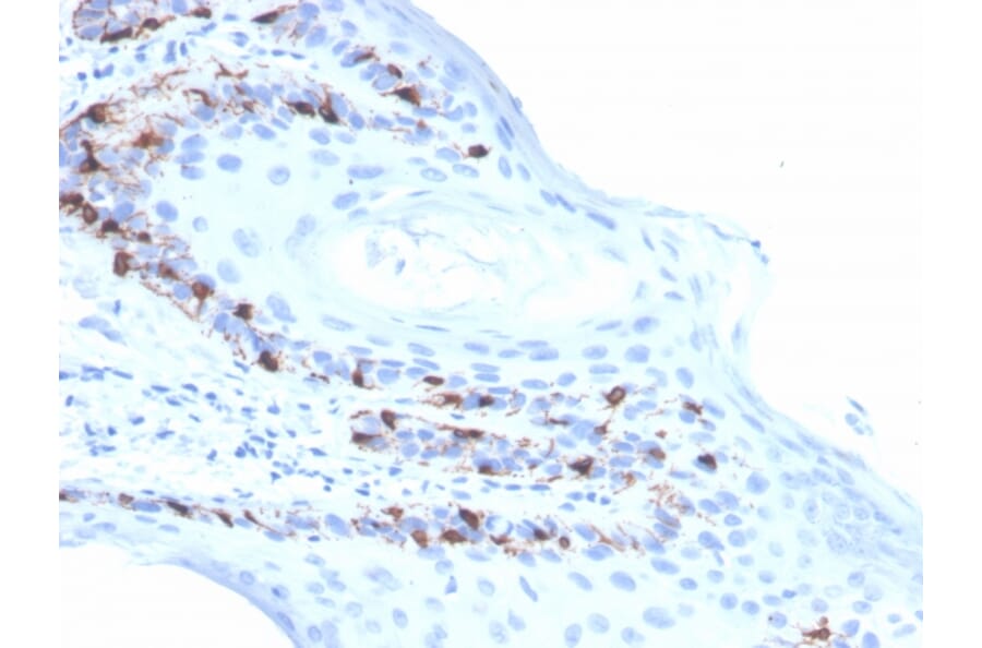 Immunohistochemistry - Anti-MelanA Antibody [rMLANA/4576] (A251748) - Antibodies.com