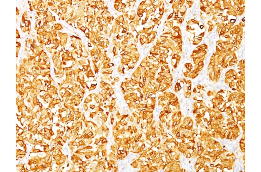 Immunohistochemistry - Anti-MelanA Antibody [M2-7C10] (A248554) - Antibodies.com