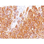 Immunohistochemistry - Anti-MelanA Antibody [M2-7C10] (A248553) - Antibodies.com