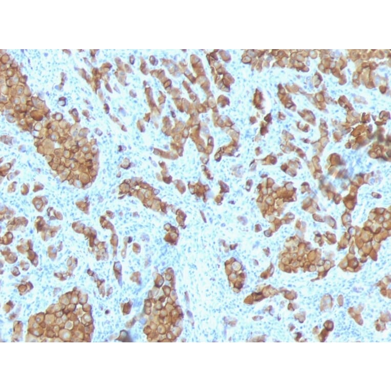 Immunohistochemistry - Anti-MelanA Antibody [SPM342] (A248554) - Antibodies.com