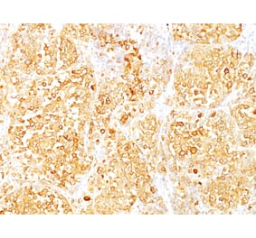 Immunohistochemistry - Anti-MelanA Antibody [M2-9E3] (A248556) - Antibodies.com