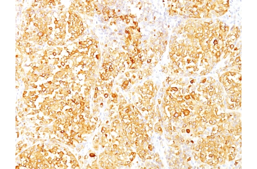 Immunohistochemistry - Anti-MelanA Antibody [M2-9E3] (A248556) - Antibodies.com