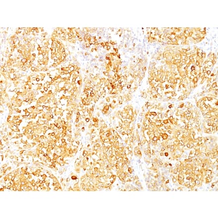 Immunohistochemistry - Anti-MelanA Antibody [M2-9E3] (A248556) - Antibodies.com