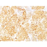 Immunohistochemistry - Anti-MelanA Antibody [M2-9E3] (A248556) - Antibodies.com