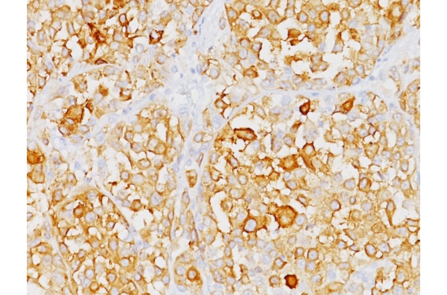 Immunohistochemistry - Anti-MelanA Antibody [M2-9E3] (A248555) - Antibodies.com