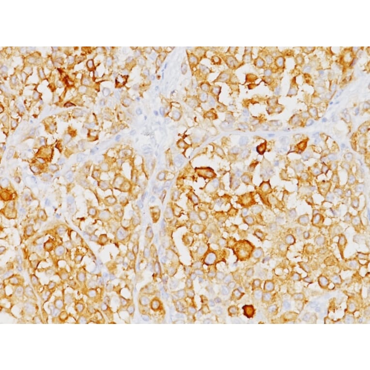 Immunohistochemistry - Anti-MelanA Antibody [M2-9E3] (A248555) - Antibodies.com