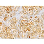 Immunohistochemistry - Anti-MelanA Antibody [M2-9E3] (A248555) - Antibodies.com