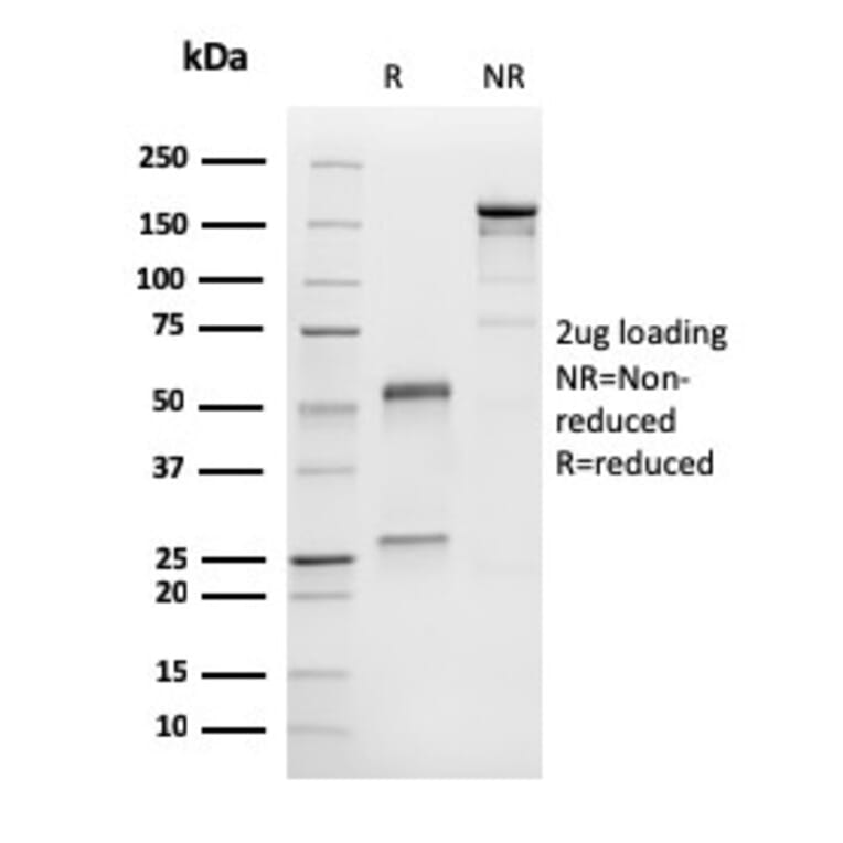 SDS-PAGE - Anti-MelanA Antibody [M2-9E3] (A248556) - Antibodies.com