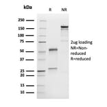 SDS-PAGE - Anti-MelanA Antibody [M2-9E3] (A248556) - Antibodies.com