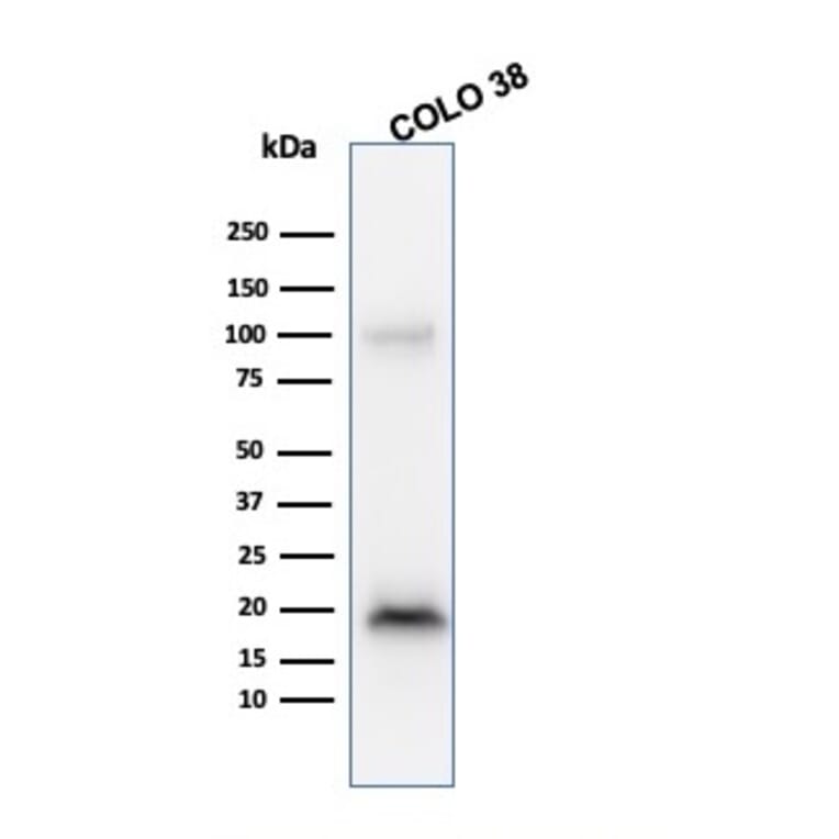 Western Blot - Anti-MelanA Antibody [M2-9E3] (A248556) - Antibodies.com