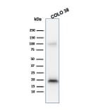 Western Blot - Anti-MelanA Antibody [M2-9E3] (A248556) - Antibodies.com