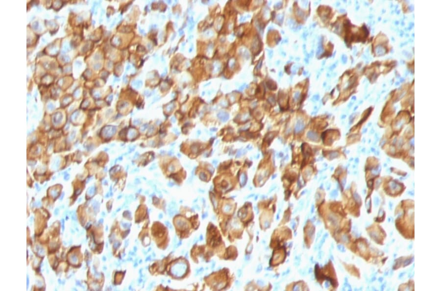 Immunohistochemistry - Anti-MelanA Antibody [SPM540] (A248556) - Antibodies.com