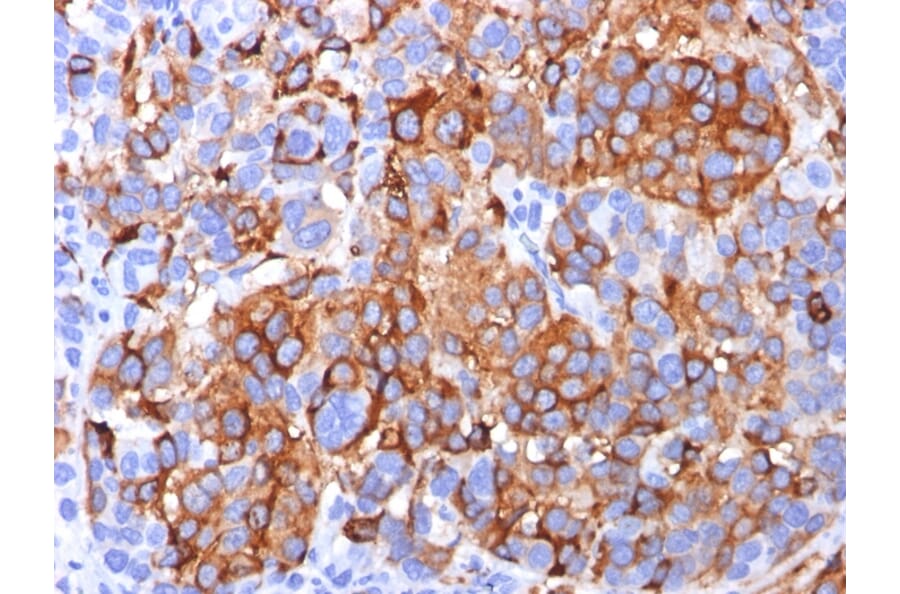 Immunohistochemistry - Anti-MelanA Antibody [A103] (A248557) - Antibodies.com