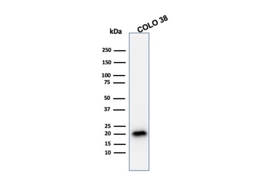Western Blot - Anti-MelanA Antibody [A103] (A248558) - Antibodies.com