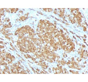 Immunohistochemistry - Anti-MelanA Antibody [SPM555] (A248558) - Antibodies.com