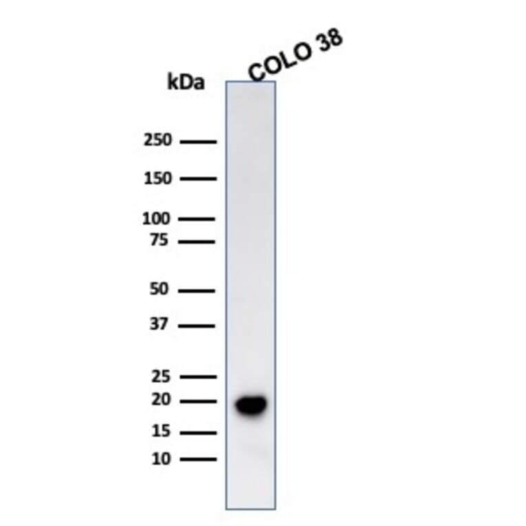 Western Blot - Anti-MelanA Antibody [SPM555] (A248559) - Antibodies.com