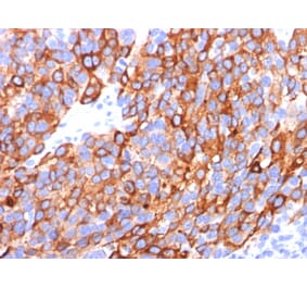 Immunohistochemistry - Anti-MelanA Antibody [A103 + M2-7C10 + M2-9E3] (A248559) - Antibodies.com