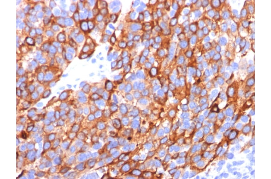 Immunohistochemistry - Anti-MelanA Antibody [A103 + M2-7C10 + M2-9E3] (A248559) - Antibodies.com