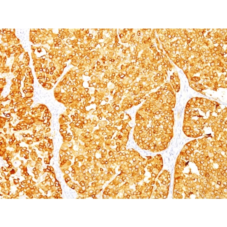 Immunohistochemistry - Anti-MelanA Antibody [M2-7C10 + M2-9E3] (A248560) - Antibodies.com