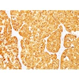 Immunohistochemistry - Anti-MelanA Antibody [M2-7C10 + M2-9E3] (A248560) - Antibodies.com