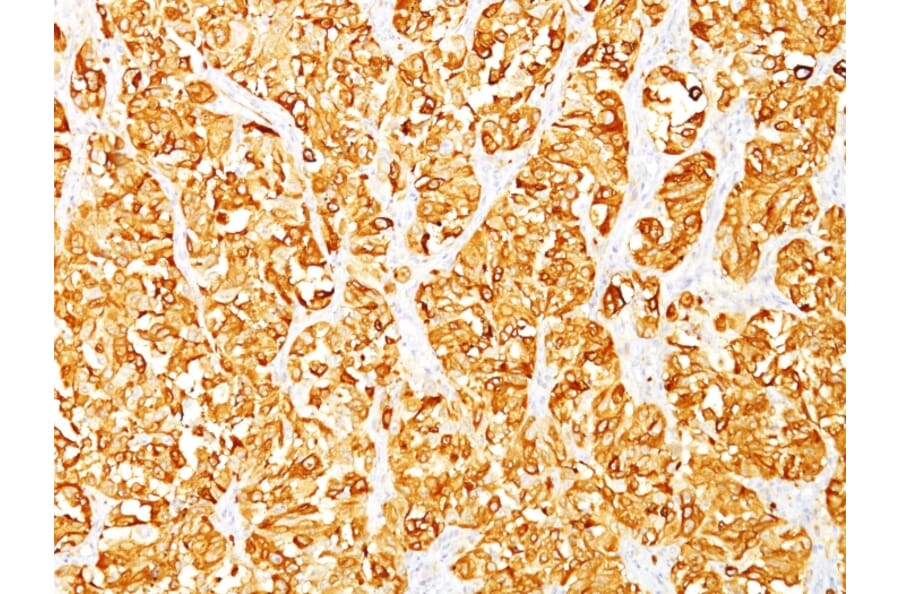 Immunohistochemistry - Anti-MelanA Antibody [DT101 + BC199] (A248562) - Antibodies.com
