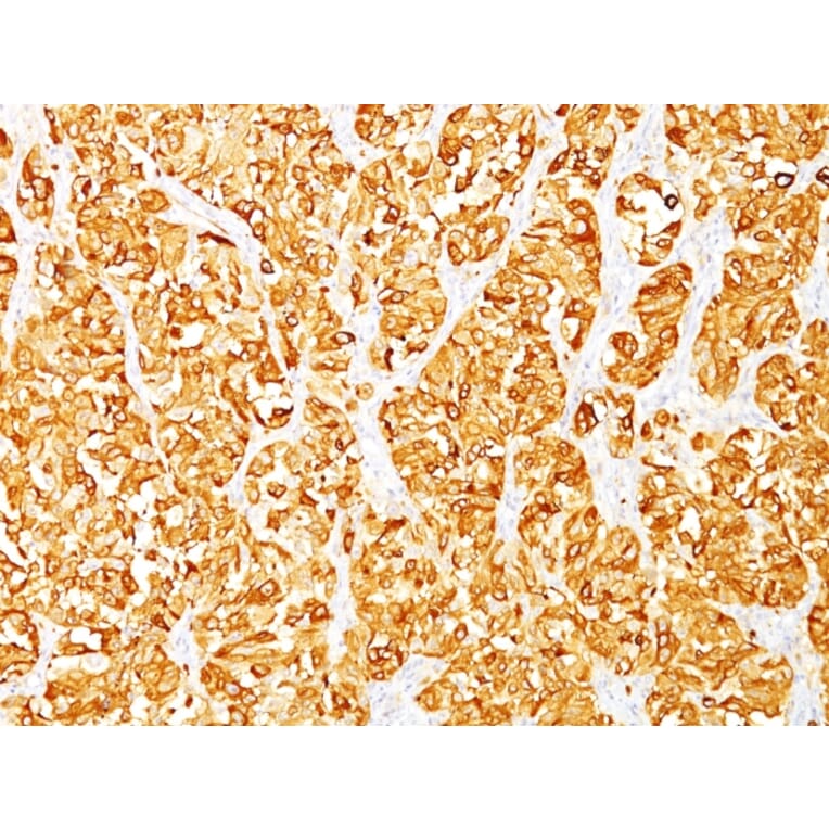 Immunohistochemistry - Anti-MelanA Antibody [DT101 + BC199] (A248562) - Antibodies.com