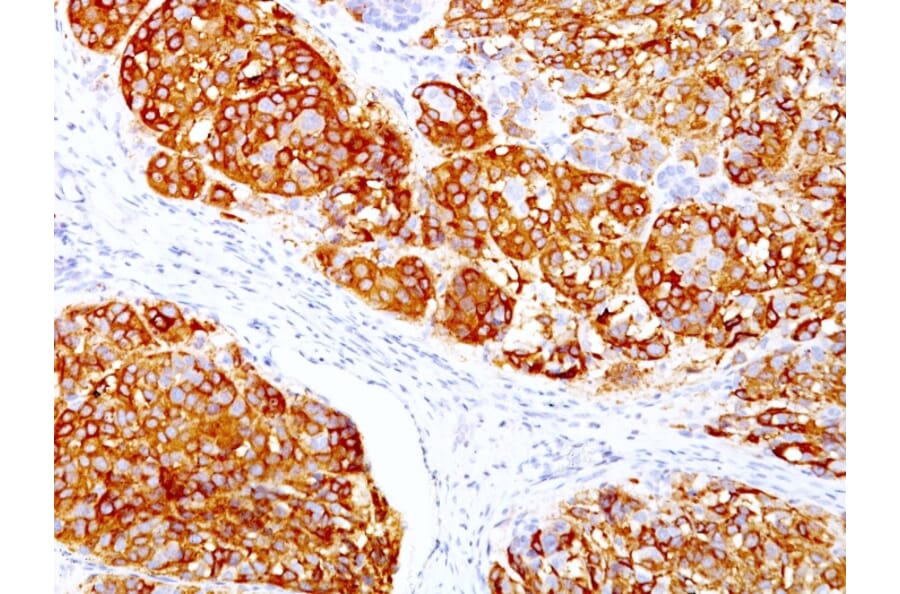 Immunohistochemistry - Anti-MelanA Antibody [DT101 + BC199] (A248561) - Antibodies.com