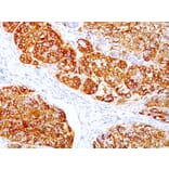 Immunohistochemistry - Anti-MelanA Antibody [DT101 + BC199] (A248561) - Antibodies.com