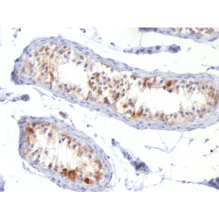Immunohistochemistry - Anti-MelanA Antibody [MLANA/788] (A248563) - Antibodies.com