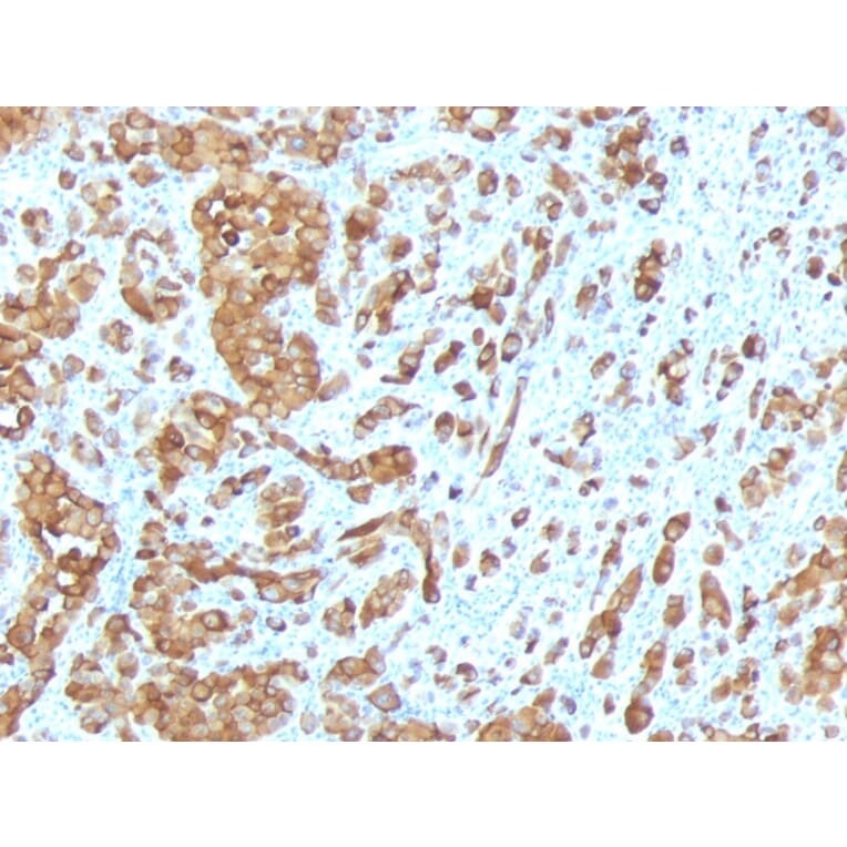 Immunohistochemistry - Anti-MelanA Antibody [MLANA/788] (A248562) - Antibodies.com