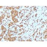 Immunohistochemistry - Anti-MelanA Antibody [MLANA/788] (A248562) - Antibodies.com
