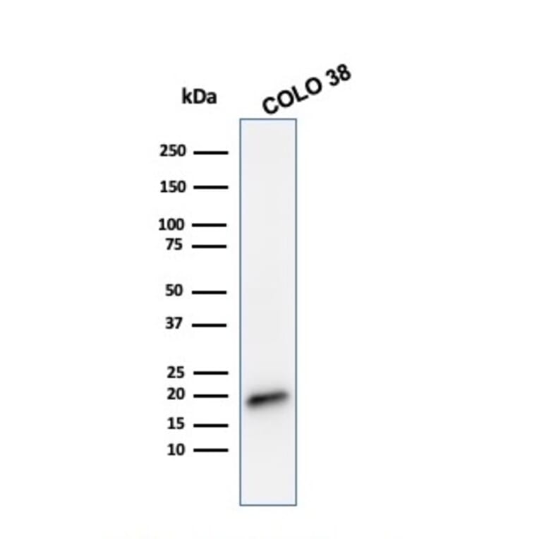 Western Blot - Anti-MelanA Antibody [MLANA/788] (A248563) - Antibodies.com
