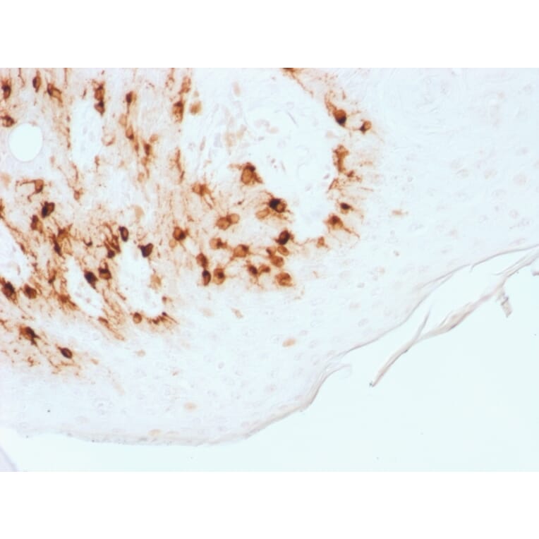 Immunohistochemistry - Anti-MelanA Antibody [MLANA/1761R] (A248564) - Antibodies.com