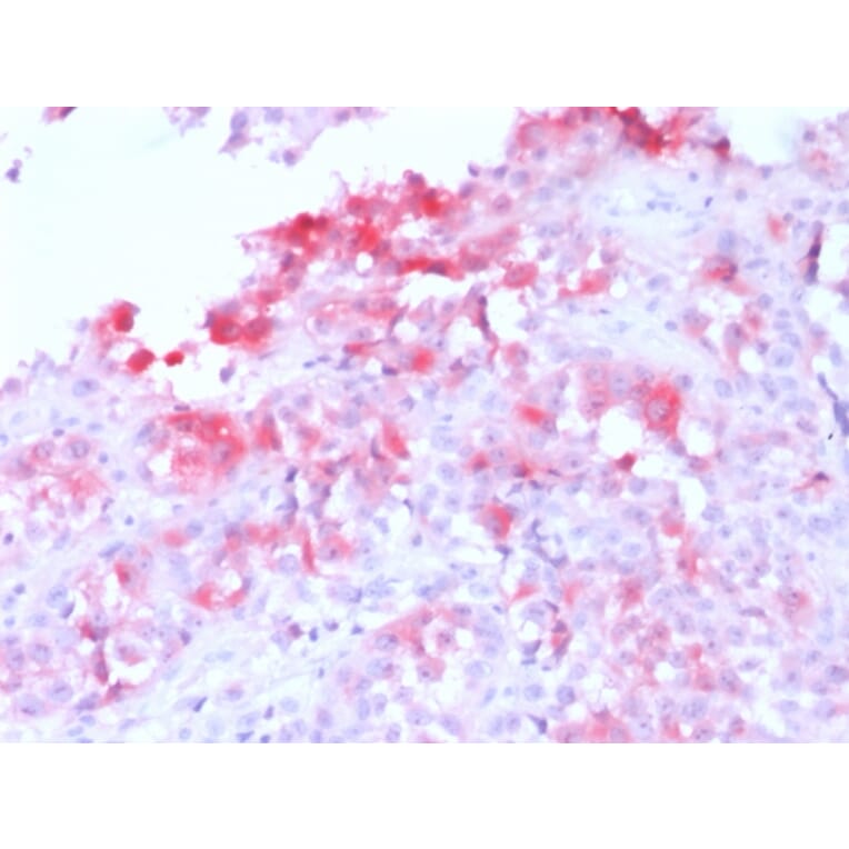 Immunohistochemistry - Anti-MelanA Antibody [MLANA/1761R] (A248563) - Antibodies.com