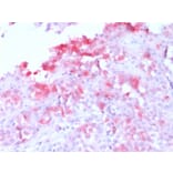 Immunohistochemistry - Anti-MelanA Antibody [MLANA/1761R] (A248563) - Antibodies.com