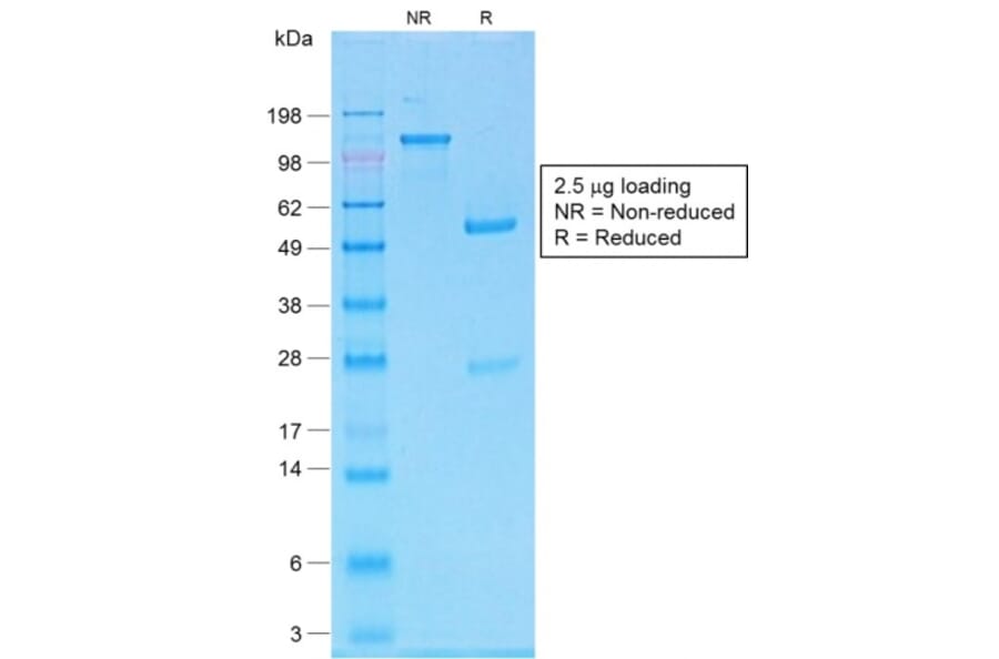SDS-PAGE - Anti-MelanA Antibody [MLANA/1761R] (A248564) - Antibodies.com