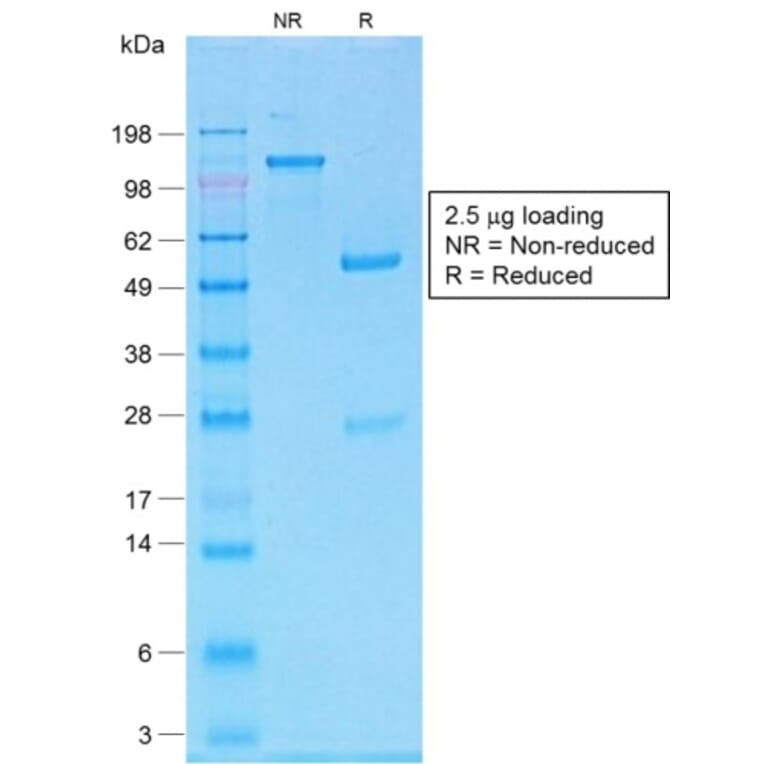 SDS-PAGE - Anti-MelanA Antibody [MLANA/1761R] (A248564) - Antibodies.com