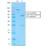 SDS-PAGE - Anti-MelanA Antibody [MLANA/1761R] (A248564) - Antibodies.com