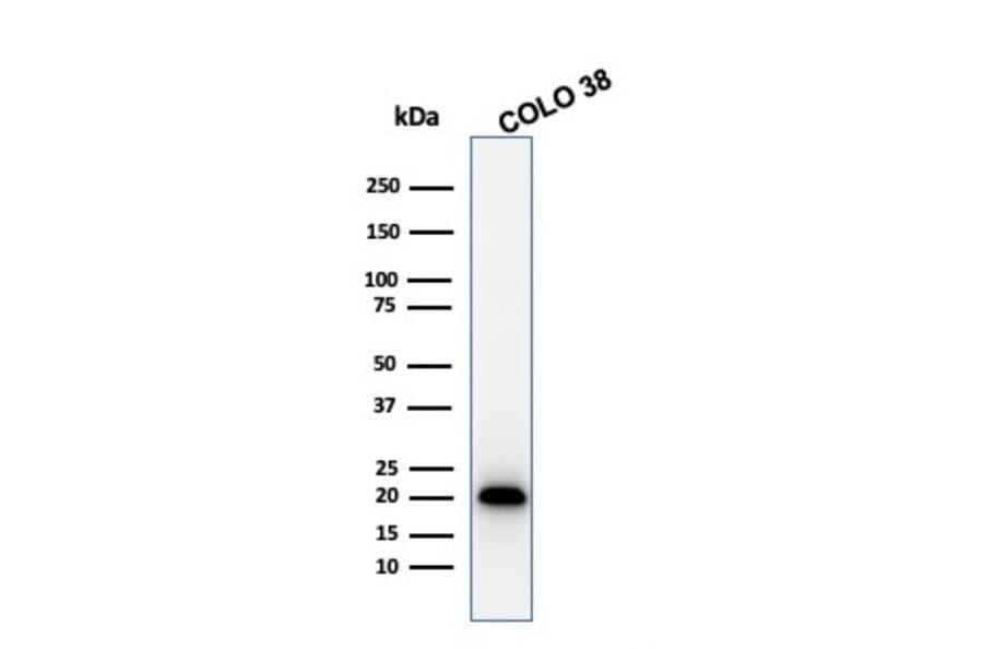 Western Blot - Anti-MelanA Antibody [MLANA/1761R] (A248564) - Antibodies.com