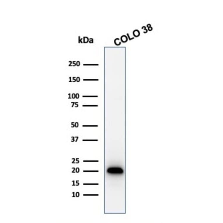 Western Blot - Anti-MelanA Antibody [MLANA/1761R] (A248564) - Antibodies.com