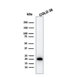 Western Blot - Anti-MelanA Antibody [MLANA/1761R] (A248564) - Antibodies.com