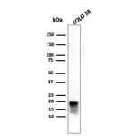 Western Blot - Anti-MelanA Antibody [MLANA/4385R] (A248565) - Antibodies.com