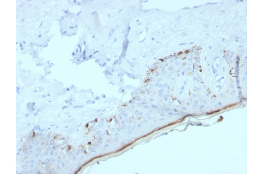 Immunohistochemistry - Anti-MelanA Antibody [MLANA/4385R] (A248564) - Antibodies.com