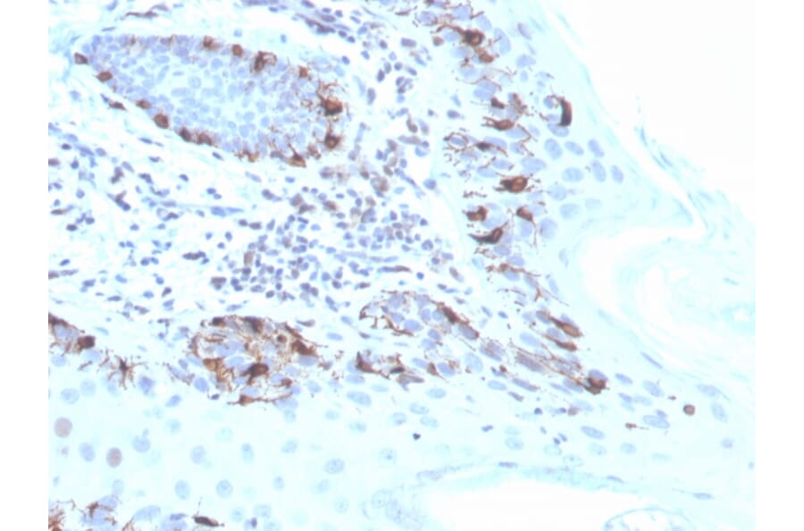 Immunohistochemistry - Anti-MelanA Antibody [MLANA/4475R] (A248566) - Antibodies.com