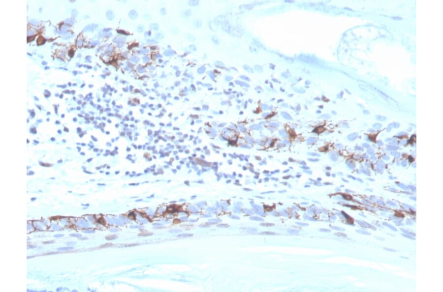 Immunohistochemistry - Anti-MelanA Antibody [MLANA/4475R] (A251747) - Antibodies.com