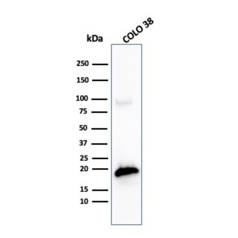 Western Blot - Anti-MelanA Antibody [MLANA/4475R] (A251747) - Antibodies.com