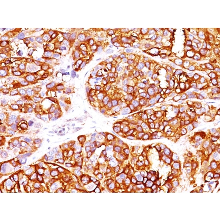 Immunohistochemistry - Anti-MelanA Antibody [MLANA/1409R] (A248566) - Antibodies.com