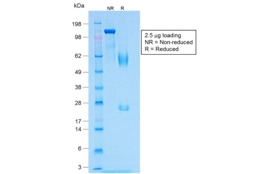 SDS-PAGE - Anti-MelanA Antibody [MLANA/1409R] (A248567) - Antibodies.com